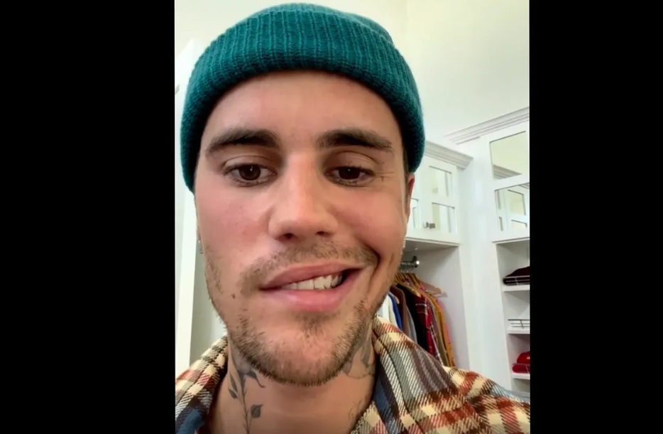 Justin Bieber y un video que publicó en sus redes con Síndrome de